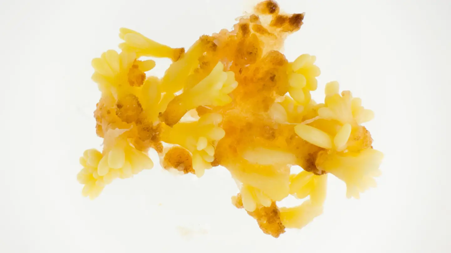 A yellow object photographed through a microscope.